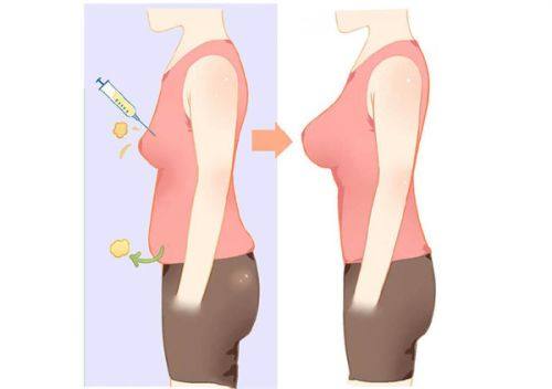 五、如何判断全切双眼皮疤痕是否正常修复