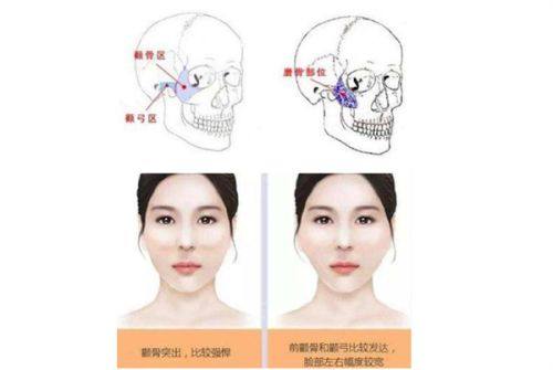 四、手感与形态:棉花糖仿生感vs荔枝Q弹挺拔感