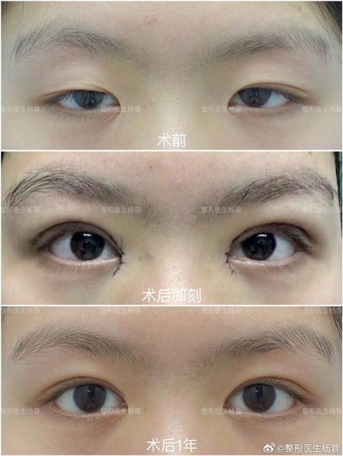 南充五星整形医院怎么样？