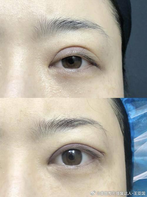 深圳荣妍医疗美容门诊部擅长项目：