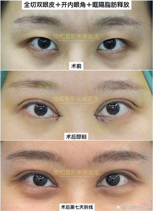 川北医学校附属医院烧伤整形美容科预约挂号方式