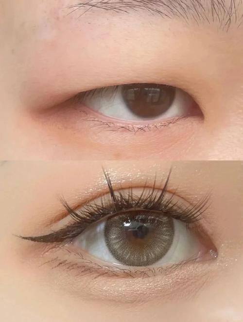 川北医学校附属医院烧伤整形美容科怎么样