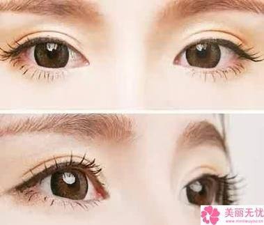 南通美贝尔整形医院地址电话及营业时间