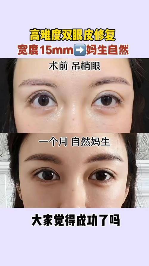 深圳荣妍医疗美容门诊部预约挂号方式：