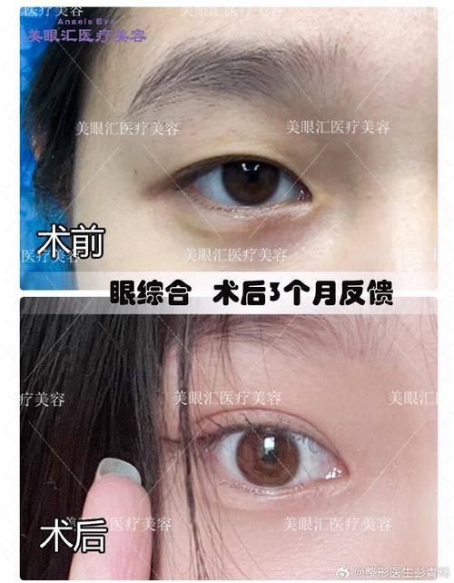 南通美贝尔整形医院口碑评价