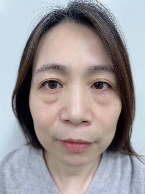 重庆铜雀台整形医院价格表: