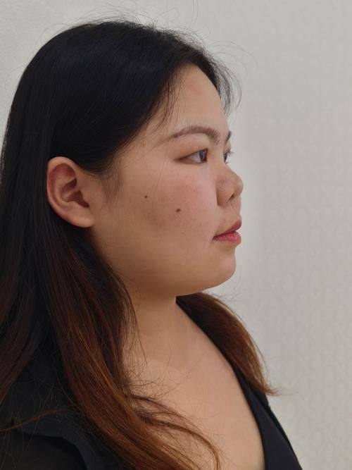 沈阳丽仙医疗整形美容诊所价格表：