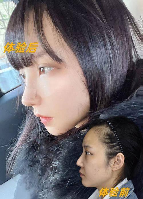 郴州欧阳小莲整形医院擅长项目: