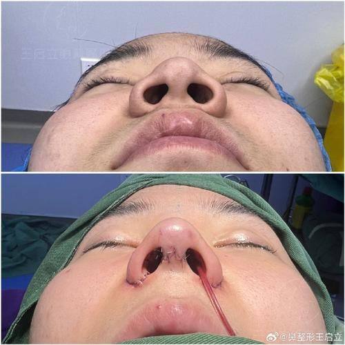 张宇恒医生怎么预约