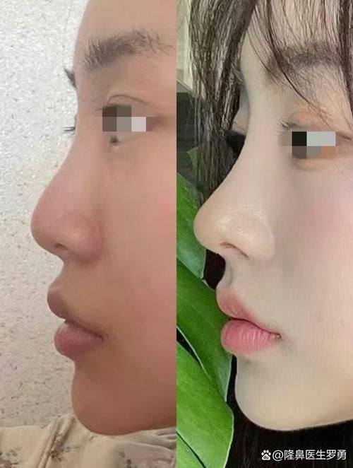 南通美贝尔整形医院价格表