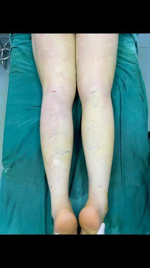 枣庄胡乐祥医疗美容整形诊所擅长项目: