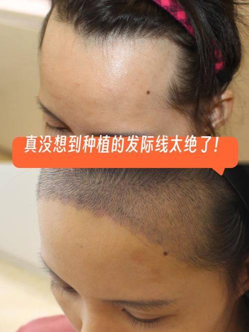 纳帕科伦医生口碑评价