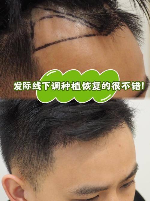 重庆铜雀台整形医院地址电话及营业时间: