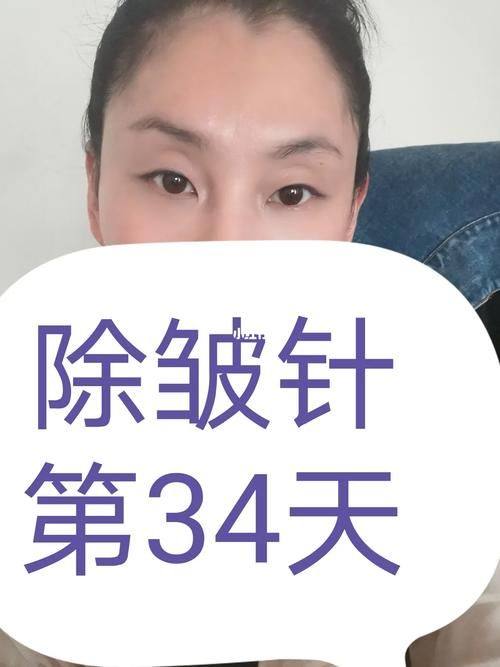 郴州欧阳小莲整形医院价格表: