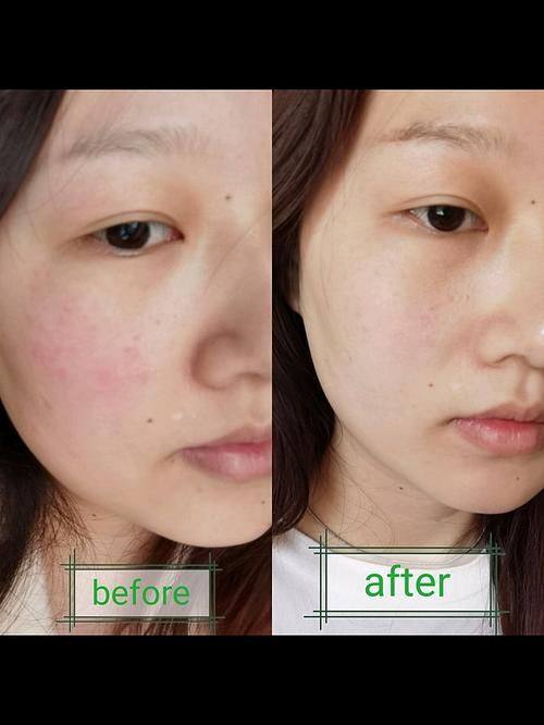 铜仁华医皮肤病医院预约挂号方式: