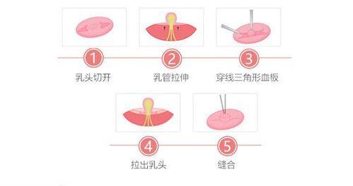 Santiphap医生口碑评价：