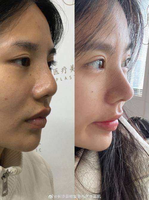 济南西子医疗美容门诊部擅长项目