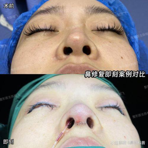 清镇市利美康整形医院预约挂号方式: