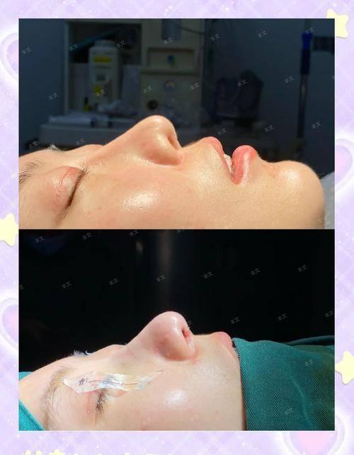 武警吉林省总队医院擅长项目: