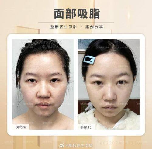 嘉峪关舒丽雅医疗美容诊所价格表：