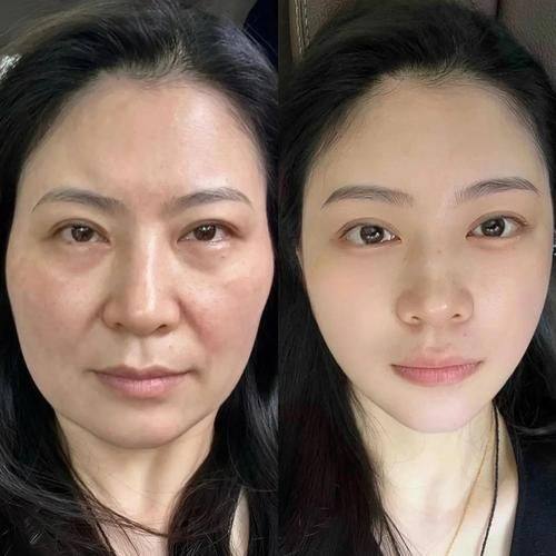 重庆市妇幼保健院(医学美容科)预约挂号方式：