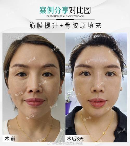 郴州欧阳小莲整形医院地址电话及营业时间: