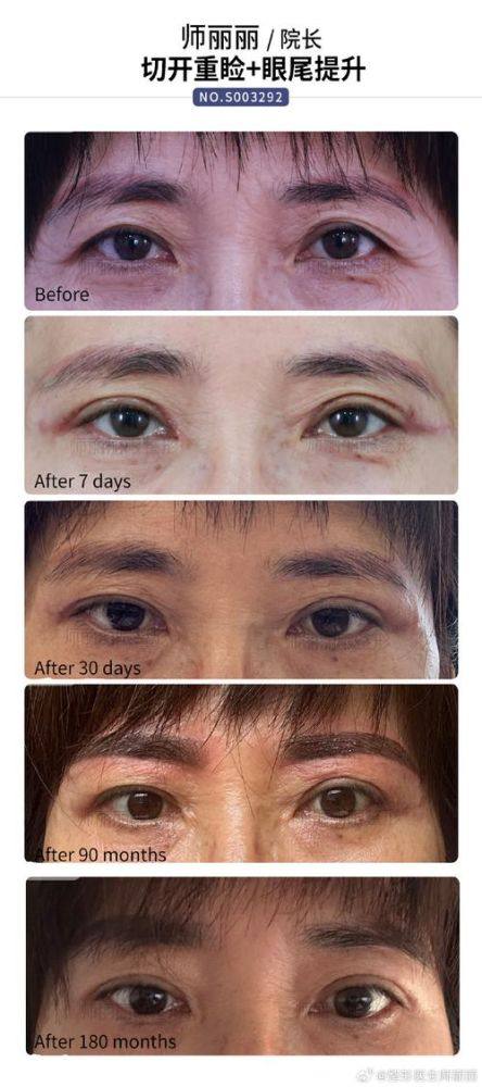 南充五星整形医院擅长项目