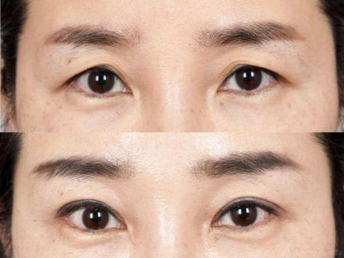 邹浅医生怎么预约