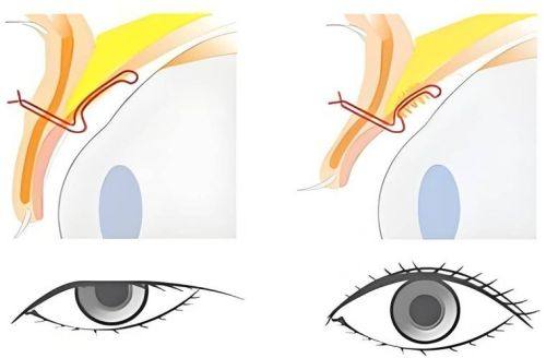 重庆市妇幼保健院(医学美容科)口碑评价：