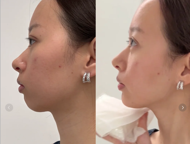 五、如何科学选择增生疤痕修复方案？