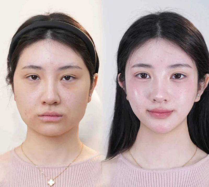 长沙黛恩美医疗美容门诊部擅长项目: