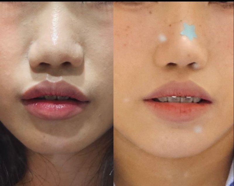 深圳荣妍医疗美容门诊部地址电话及营业时间：