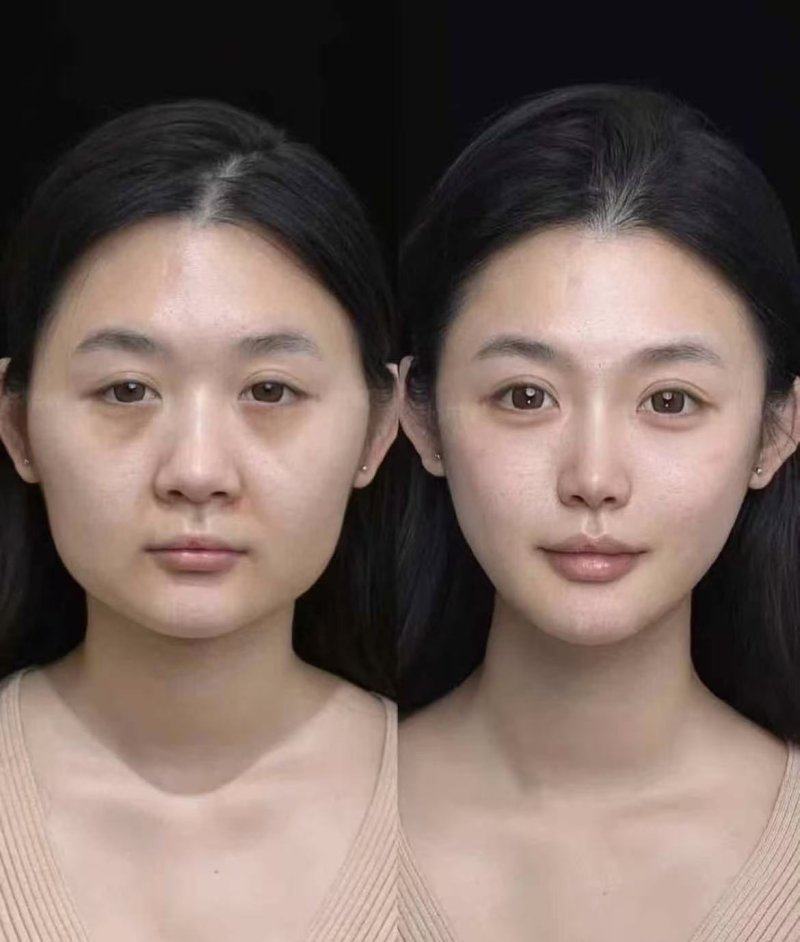 四、辟谣“十人九悔”:选对路径就能避坑