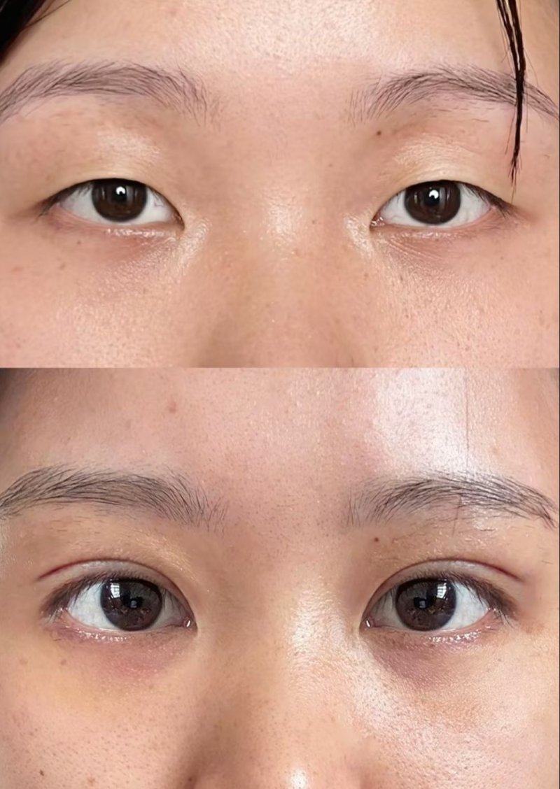 恩施奥莱整形医院口碑评价：