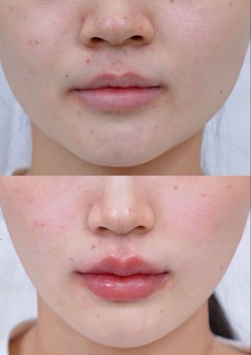 五、术后3-6个月及以后成型巩固期：回归正常生活的长期护理