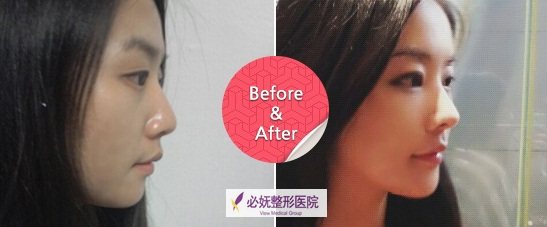 韩国必妩整形外科医院价格表：