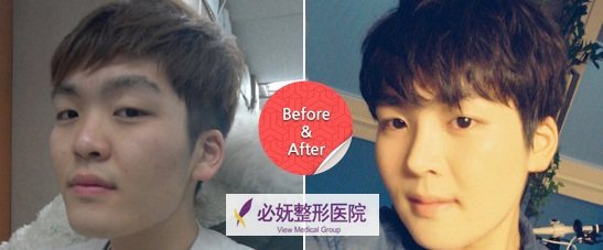 韩国必妩整形外科医院预约挂号方式：