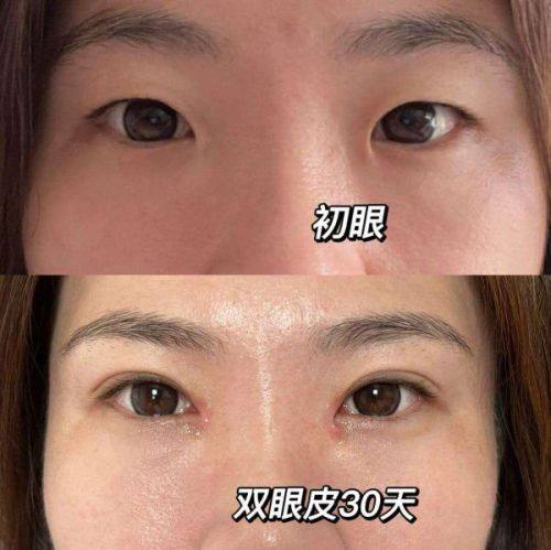 青岛安氏专科整形门诊部预约挂号方式：