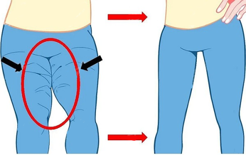 四、细胞激活祛眼袋的相关产品