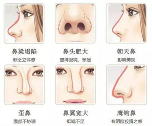 五、日常预防:从细节降低疤痕增生起泡风险