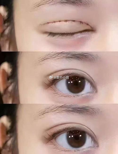 青岛安氏专科整形门诊部擅长项目：