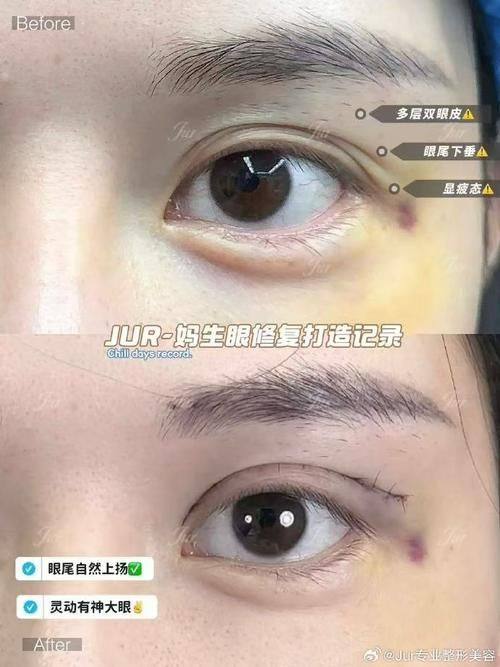 Santiphap医生技术优势