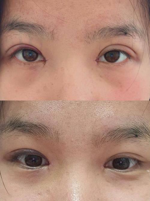 荆门华美仁爱整形美容价格表: