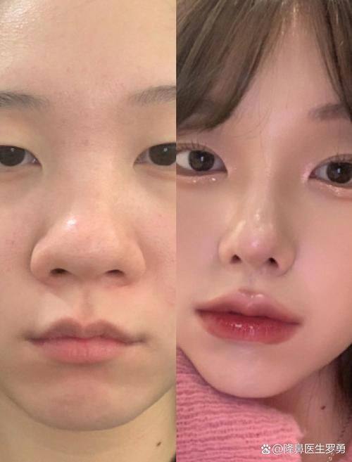 青岛安氏专科整形门诊部价格表：