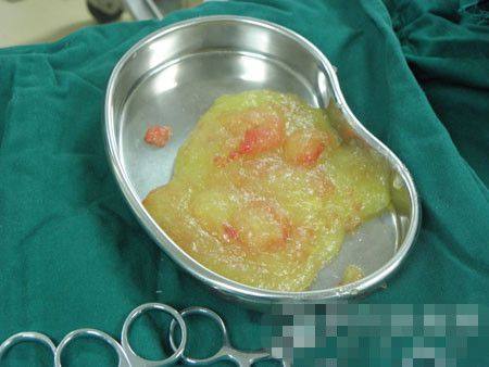 武汉美都医疗美容门诊部价格表