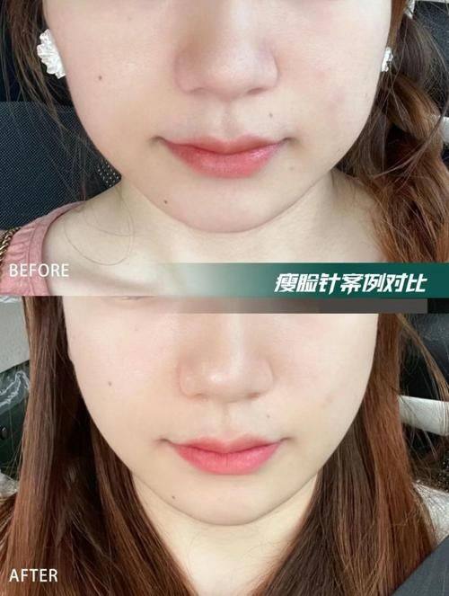 哈尔滨名一整形医疗美容门诊部价格表