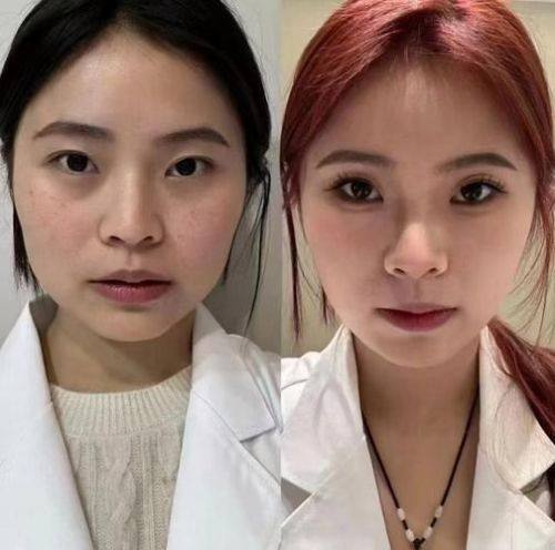 郑州健丽医疗美容诊所价格表: