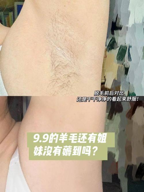 刘晨涛医生怎么预约