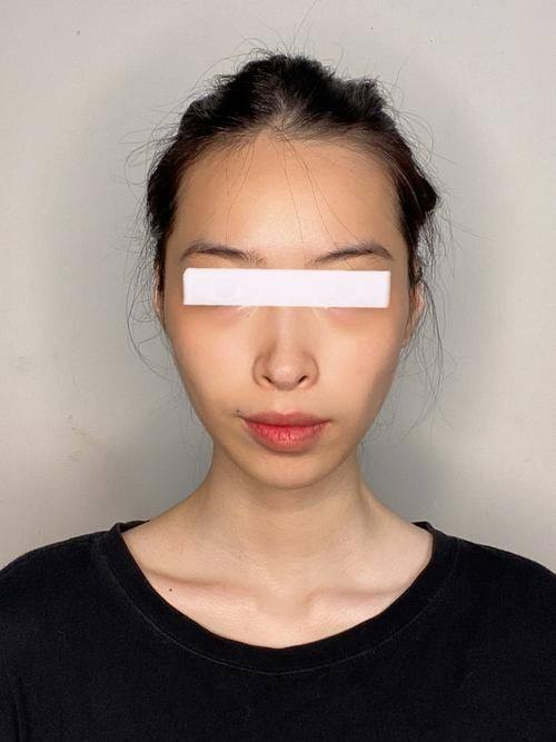 宁波韩美医疗美容门诊部价格表