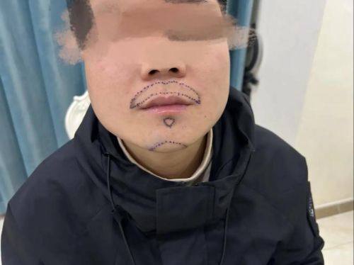 Wichuda医生口碑评价: